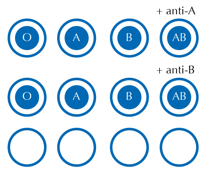 blood typing