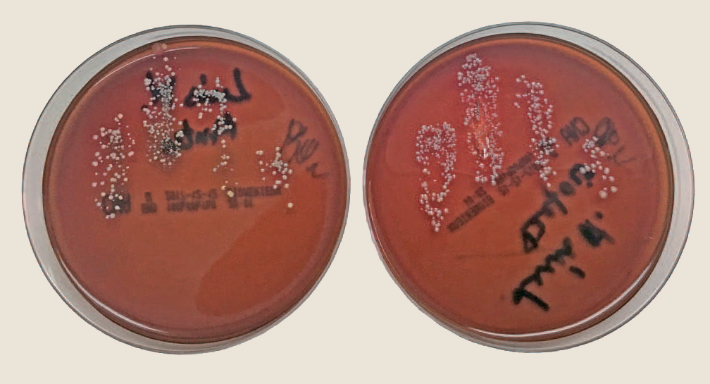 'Before' and 'after' agar plates for pupil 8