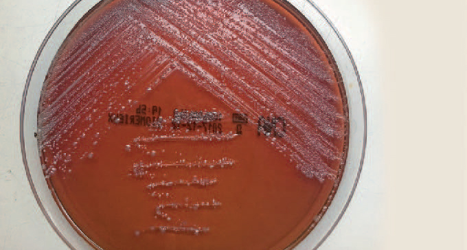 Isolated S. epidermis