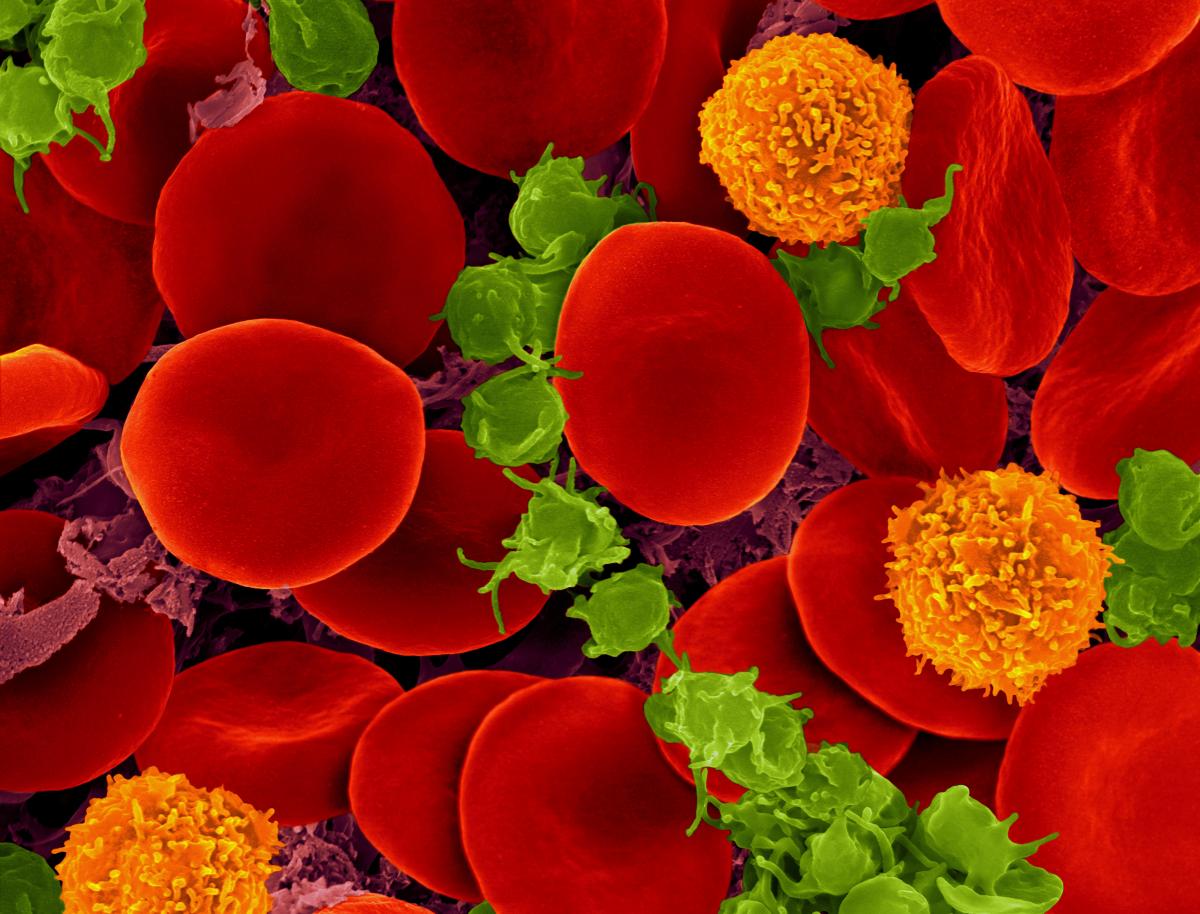 Human blood, showing biconcave red blood cells