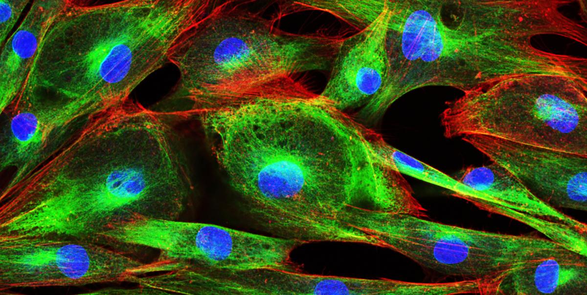 Human skin cells in culture