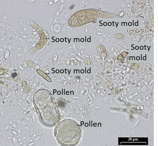 honeydew analyzed to the microscope. There are a few pollen grains (round), many fungi (elongated) and other particles.